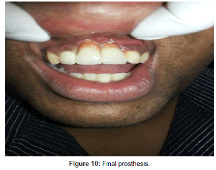 interdisciplinary-medicine-dental-science-prosthesis