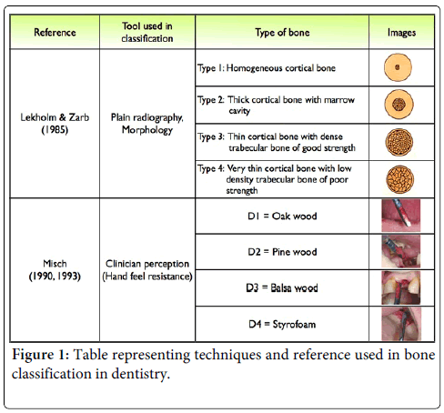 Reference and Techniques used in Alveolar Bone Classification | OMICS  International