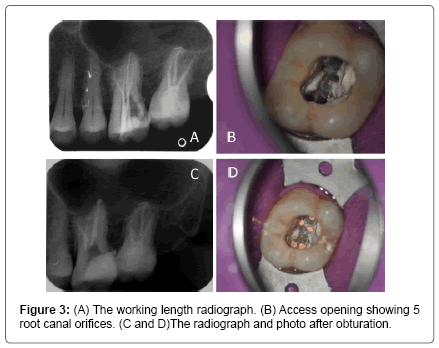 interdisciplinary-medicine-dental-science-working-length-radiograph