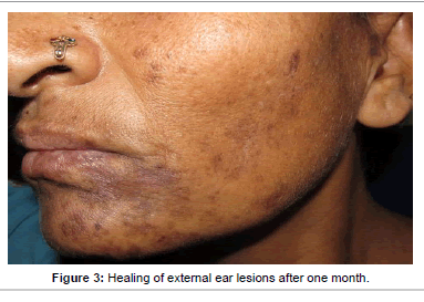 interdisciplinary-medicine-external-ear-lesions