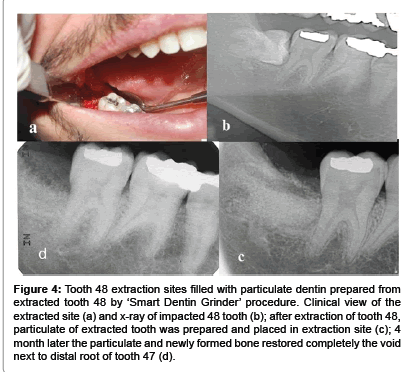interdisciplinary-medicine-formed-bone-restored