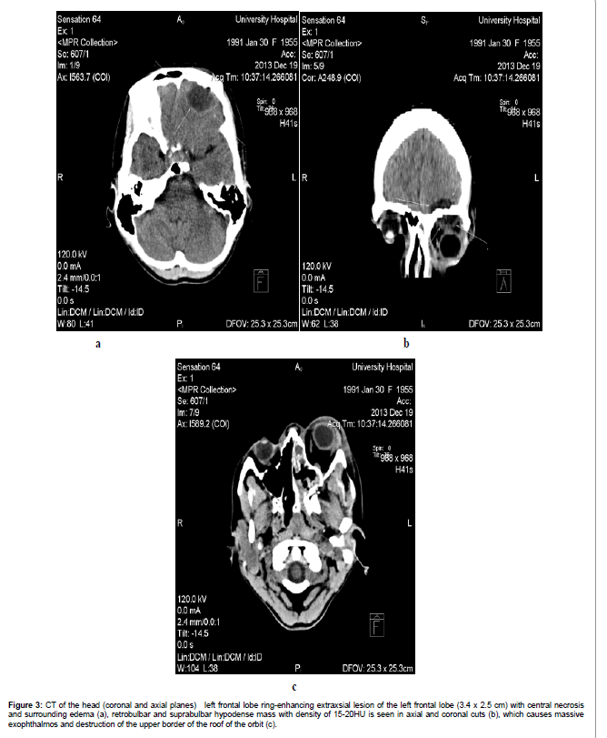 interdisciplinary-medicine-frontal-lobe-ring