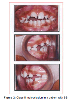 interdisciplinary-medicine-malocclusion-patient-SS