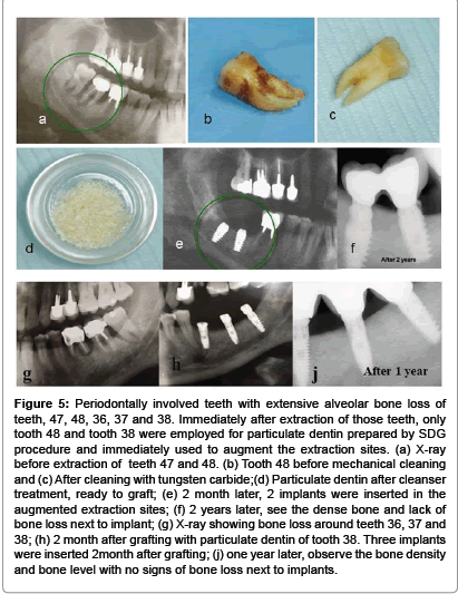 interdisciplinary-medicine-month-after-grafting