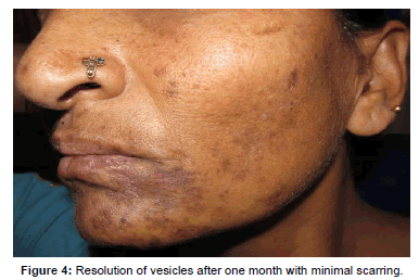 interdisciplinary-medicine-month-minimal-scarring