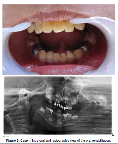 interdisciplinary-medicine-radiographic-view-oral