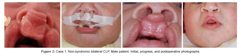 interdisciplinary-medicine-syndromic-bilateral