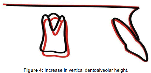interdisciplinary-medicine-vertical-dentoalveolar