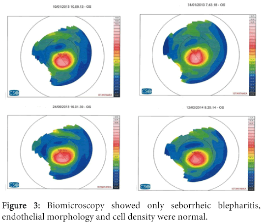 interdisciplinary-microinflammation-Biomicroscopy-showed-seborrheic