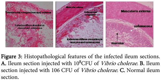 interdisciplinary-microinflammation-Histopathological-features-infected