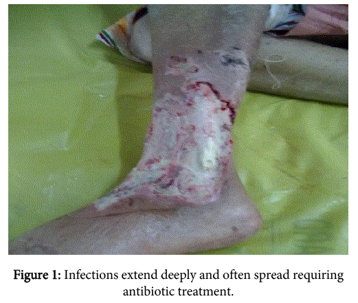 interdisciplinary-microinflammation-Infections-extend