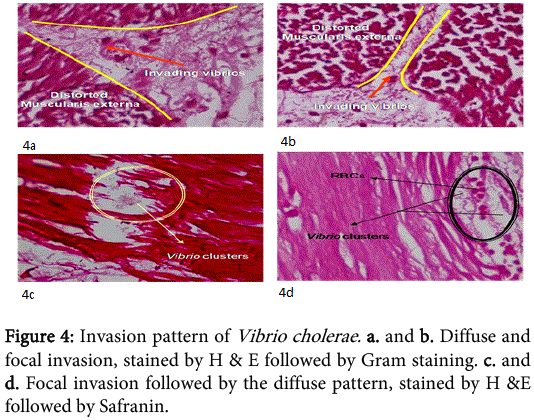 interdisciplinary-microinflammation-Invasion-pattern-Vibrio