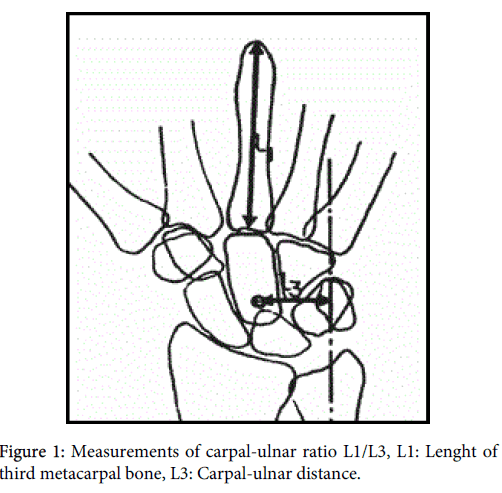 interdisciplinary-microinflammation-Measurements-carpal