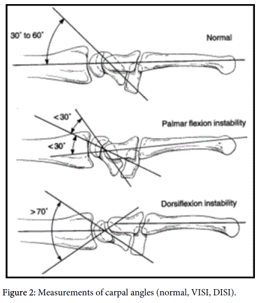interdisciplinary-microinflammation-Measurements-carpal