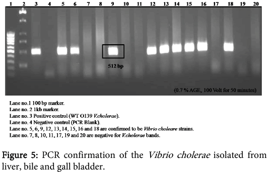 interdisciplinary-microinflammation-PCR-confirmation-Vibrio
