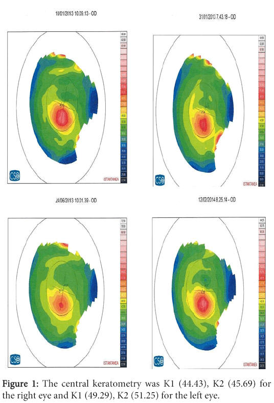 interdisciplinary-microinflammation-central-keratometry