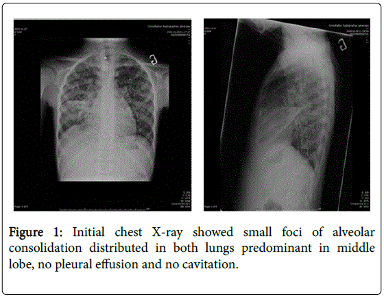 interdisciplinary-microinflammation-chest-x-ray
