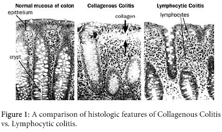 interdisciplinary-microinflammation-comparison-histologic-features