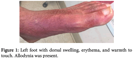 interdisciplinary-microinflammation-dorsal-swelling-erythema