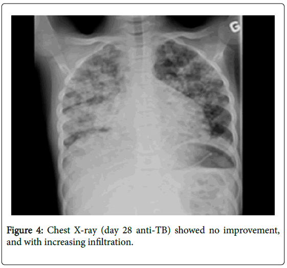 interdisciplinary-microinflammation-increasing-infiltration