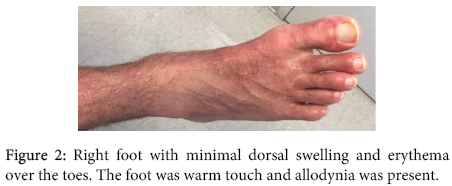 interdisciplinary-microinflammation-minimal-dorsal-swelling
