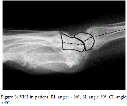 interdisciplinary-microinflammation-patient-RL-angle