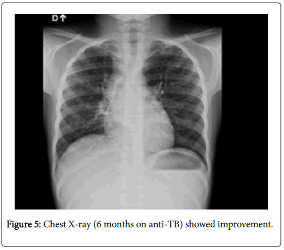 interdisciplinary-microinflammation-showed-improvement