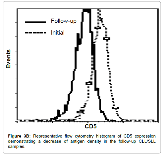 leukemia antigen density antigen density chart flow cytometry
