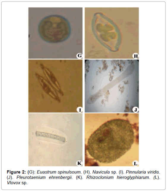 marine-science-research-Euastrum-spinulsoum