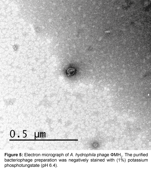 marine-science-research-development-Electron-micrograph