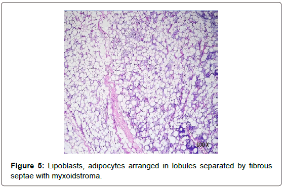 Mature adipocytes fibrovascular trabeculae unexpectedness! That mature adipocytes fibrovascular trabeculae