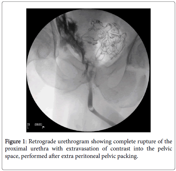 Retrograde Urethrogram Anatomy