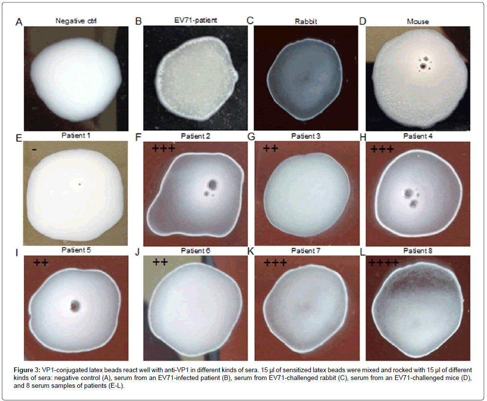 Development of a Specific Latex Agglutination Test to Detect Antibodies
