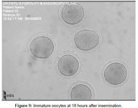 post mature cumulus oocyte Mtf tranny lesbian sex