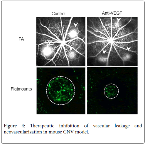 size matrix in nuclear medicine medicine genetic neovascularization molecular size matrix in nuclear medicine medicine genetic neovascularization molecular