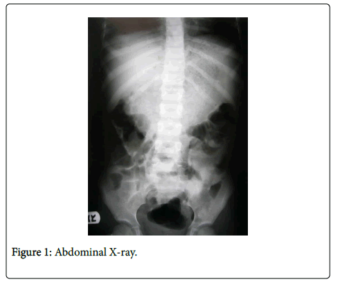 neonatal-and-pediatric-medicine-abdominal