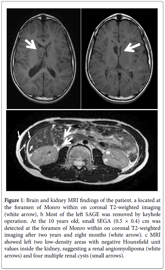 neonatal-pediatric-medicine-brain-kidney