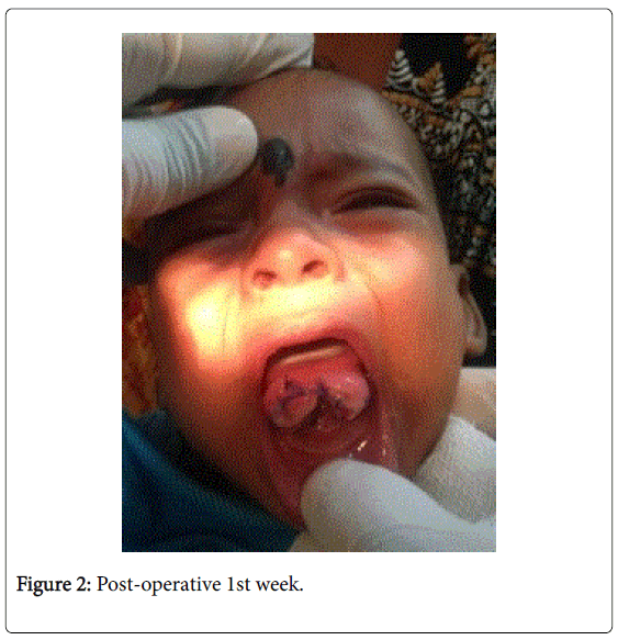 neonatal-pediatric-medicine-post-operative-week