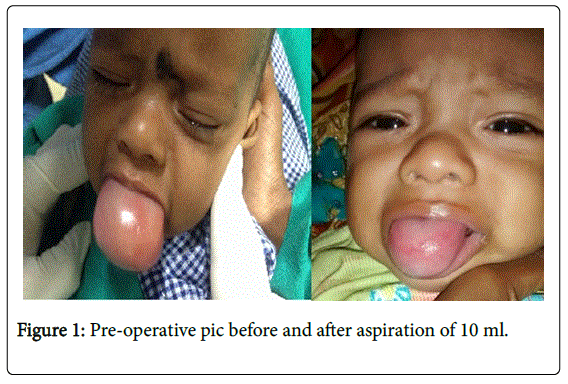 neonatal-pediatric-medicine-pre-operative-pic