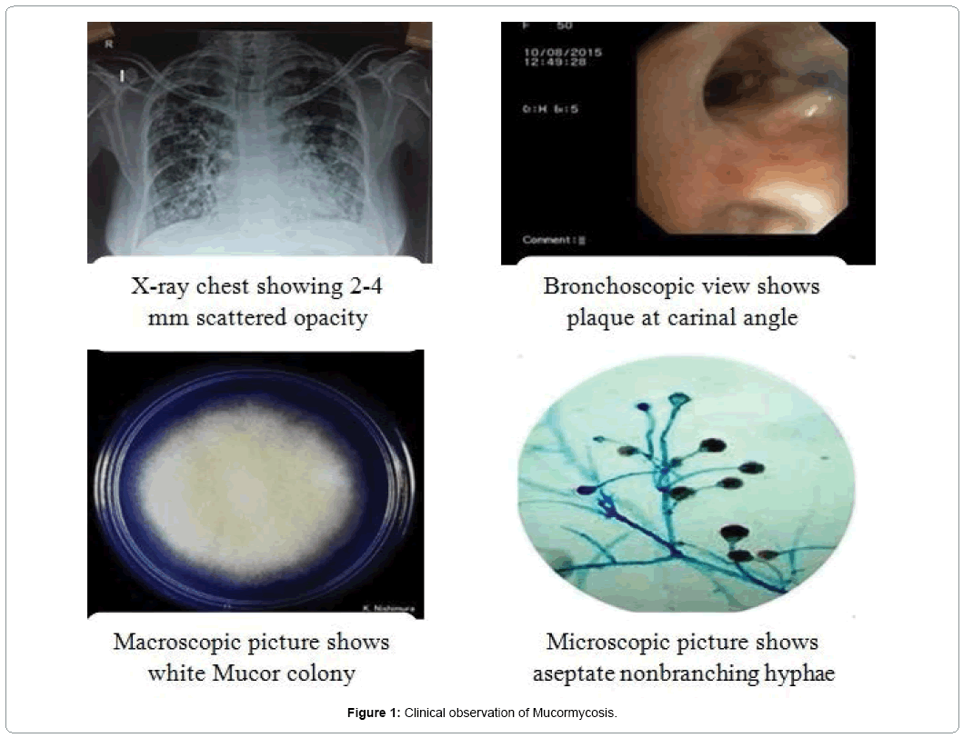 nephrology-therapeutics-Mucormycosis