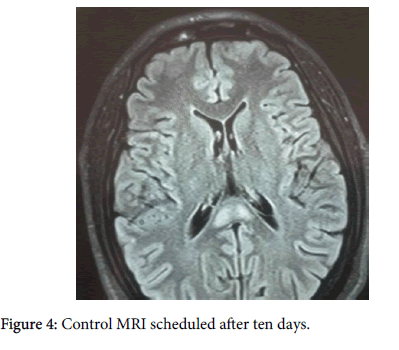 neuroinfectious-diseases-Control-MRI-scheduled