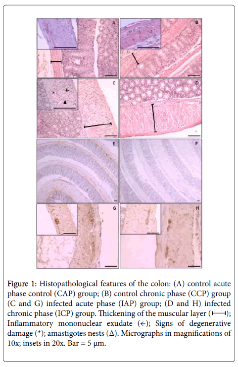 neuroinfectious-diseases-Histopathological-features-colon