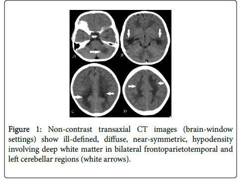neuroinfectious-diseases-Non-contrast-transaxial