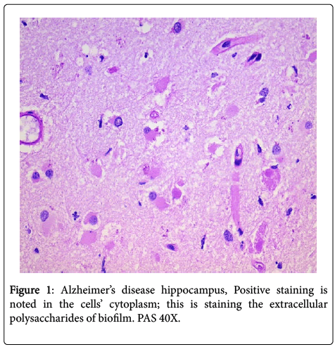neuroinfectious-diseases-Positive-staining