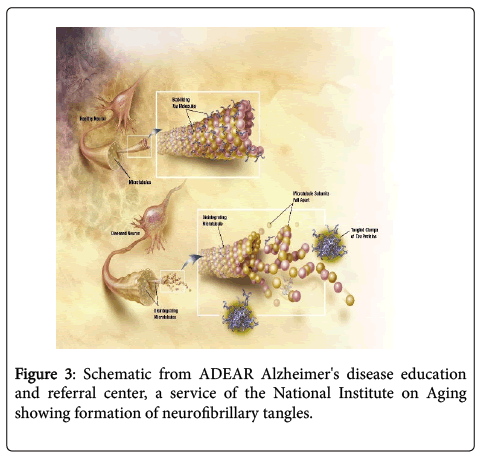 neuroinfectious-diseases-disease-education