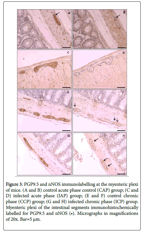 neuroinfectious-diseases-immunolabelling-myenteric-plexi