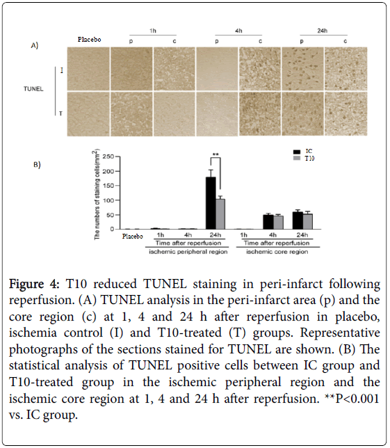 neuroinfectious-diseases-peri-infarct-TUNEL