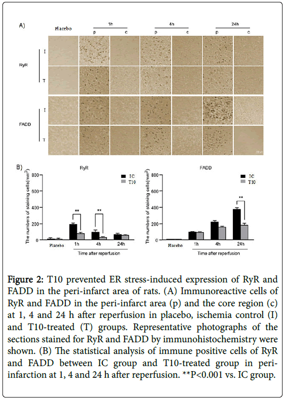 neuroinfectious-diseases-prevented-stress-induced