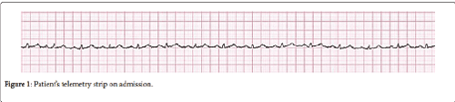 neuroinfectious-diseases-telemetry-strip