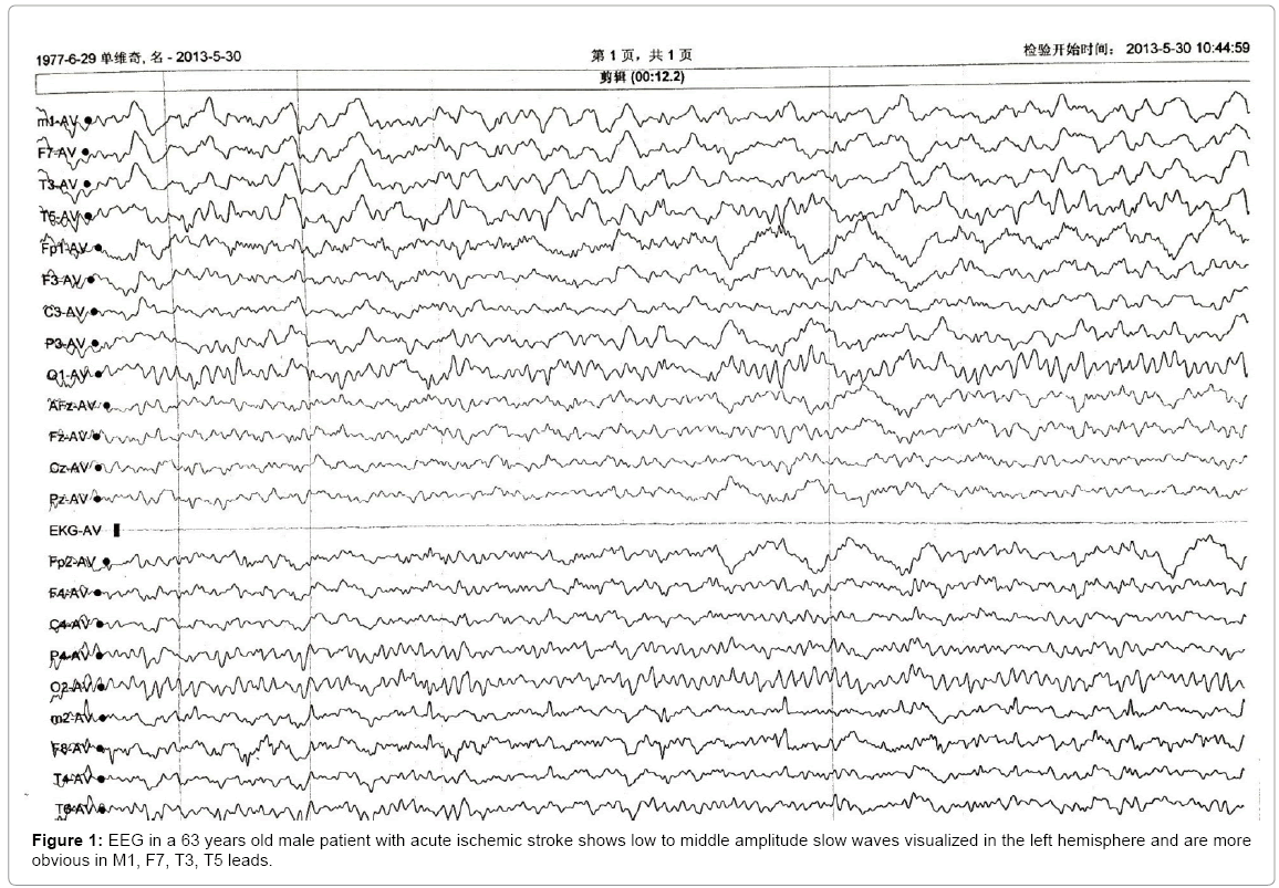 Dating stroke radiographics